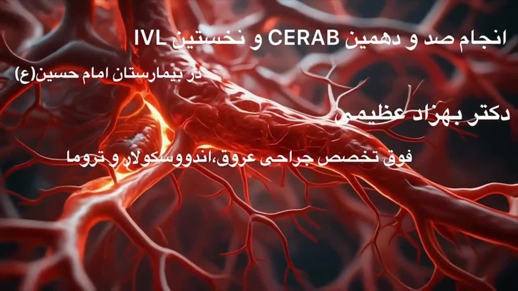 انجام صد و دهمین عمل CERAB برای درمان انسداد آئورتوایلیاک در بیمارستان امام حسین(ع)